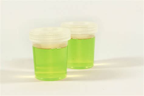 urina verde